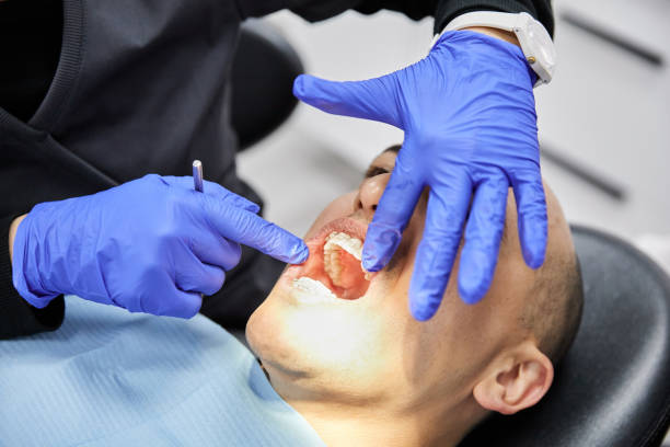 Best Emergency Dentist for Special Needs Patients in Somerset, MD